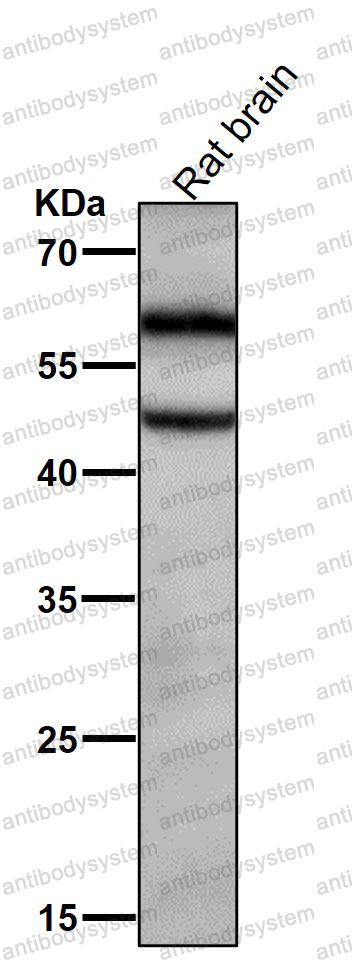 Anti-Phospho-CAMK2A (T286) Antibody (R2P04)