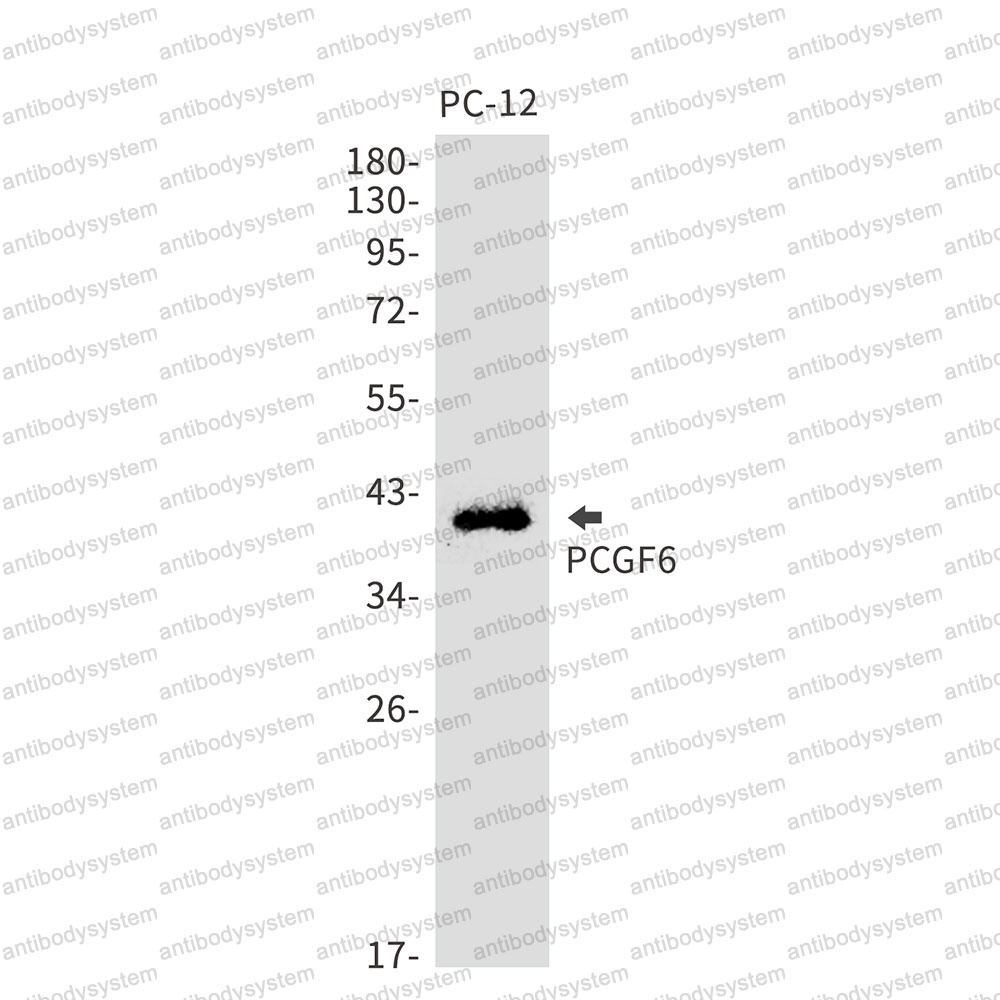 Anti-PCGF6 Antibody (R2T11)