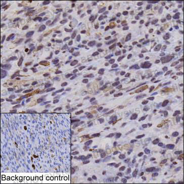 Immunohistochemical for Anti-phospho-MITF (pS157) Antibody (R2V50) ?>