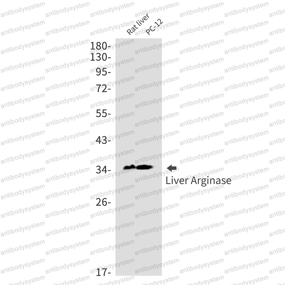 Anti-ARG1/Arginase-1 Antibody (R1J92)
