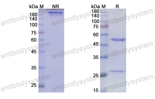 Anti-HRSV F/Fusion glycoprotein F0 Antibody (Am14)