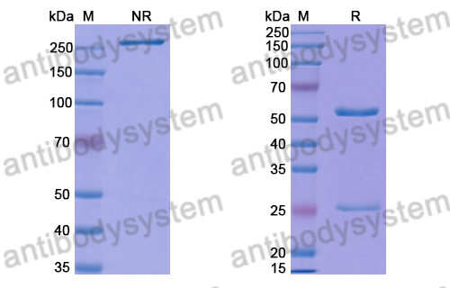 Anti-HRSV-A/BRSV F/Fusion glycoprotein F0 Antibody (B13)