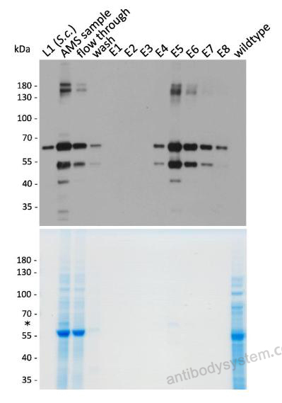 Western Blot for Anti-HPV16 L1/Major capsid protein L1 Antibody (H16.V5) ?>