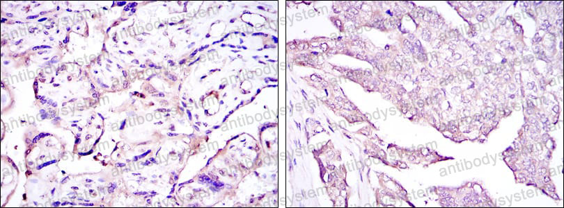 Anti-HPV16 E7/Protein E7 Antibody (R4D71)