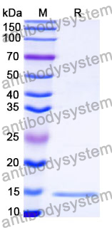 Anti-HCMV/HHV5 HHRF3/US28 Nanobody (SAA1150)