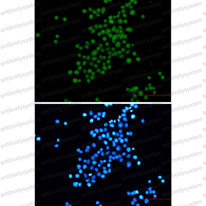 Anti-LT-AG/Large T antigen Antibody (R2T12)