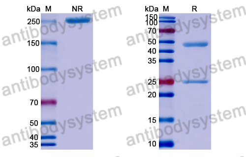 Anti-Clostridium perfringens pfo/Perfringolysin O/Theta-toxin Antibody (HS2)