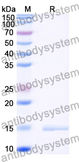 Anti-Porphyromonas gingivalis porM Nanobody (SAA0959)
