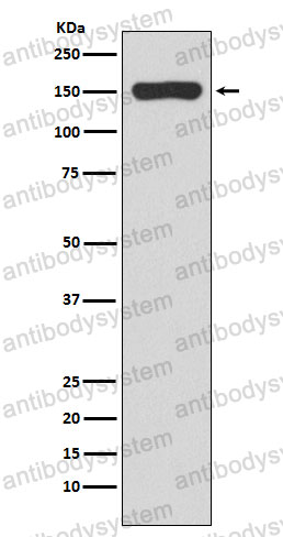 Anti-rpoB/RNA polymerase beta Antibody (R2T14)