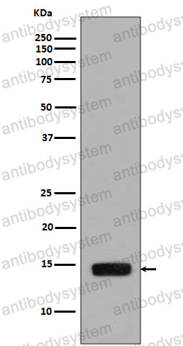 Anti-Phospho-Histone H2A (S129) Antibody (R1C03)