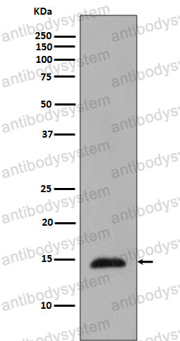Anti-Phospho-Histone H2B (T129) Antibody (R1C06)