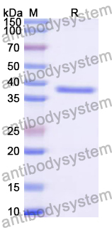 Recombinant Chicken LDHA Protein, N-His