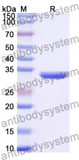 Recombinant Cat NT-ProBNP/NPPB Protein, N-GST
