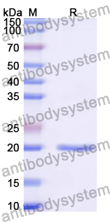 Recombinant Cat NT-ProBNP/NPPB Protein, N-His-SUMO