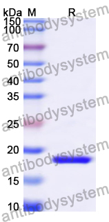 Recombinant Cat CD279/PDCD1/PD1 Protein, N-His