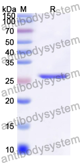 Recombinant Human IFITM5 Protein, N-His-KSI