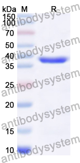 Recombinant Human ACOT7 Protein, N-His