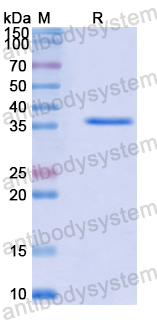 Recombinant Human FXYD1 Protein, N-GST & C-His