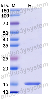 Recombinant Human MASP2 Protein, N-His