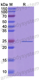 Recombinant Human RAB27B Protein, N-His