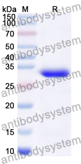 Recombinant Human SULT2B1 Protein, N-His