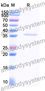 Recombinant Human CD172b/SIRPB1 Protein, N-His
