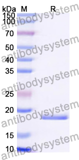Recombinant Human EIF3F Protein, N-His