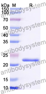 Recombinant Human CACNB4 Protein, N-His