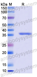 Recombinant Human SULT1C2 Protein, N-His