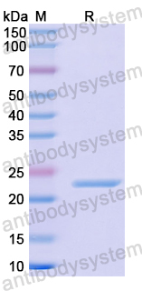 Recombinant Human DCTN6 Protein, N-His