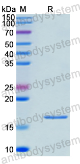 Recombinant Human WASL Protein, N-His