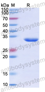Recombinant Human EEF2K Protein, N-His