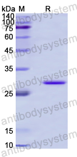 Recombinant Human PLOD2 Protein, N-His