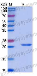 Recombinant Human PSMD14 Protein, N-His