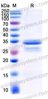 Recombinant Human DDX3X Protein, N-His