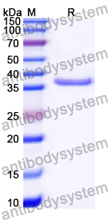 Recombinant Human PEX12 Protein, N-GST & C-His