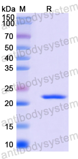 Recombinant Human E2F3 Protein, N-His-SUMO & C-Strep