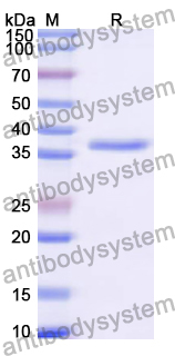 Recombinant Human PPP6C Protein, N-His