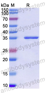 Recombinant Human WNT7A Protein, N-His