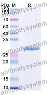 Recombinant Human AQP7 Protein, N-His-KSI