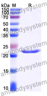 Recombinant Human SOCS6 Protein, N-His
