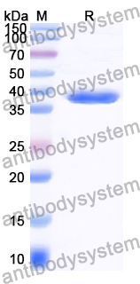 Recombinant Human DYNC1I1 Protein, N-His