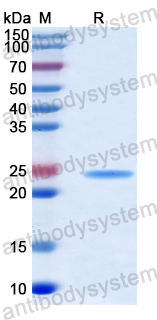 Recombinant Human DVL1 Protein, N-His-SUMO & C-Strep