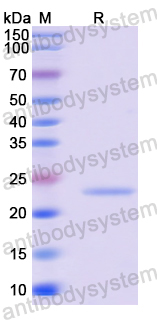 Recombinant Human DVL1 Protein, N-His-SUMO