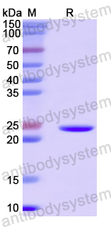 Recombinant Human DVL2 Protein, N-His-SUMO & C-Strep
