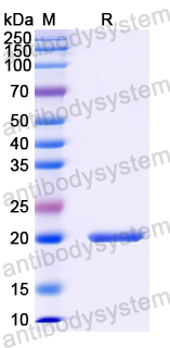 Recombinant Human CHD1 Protein, N-His