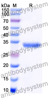 Recombinant Human ENC1 Protein, N-His