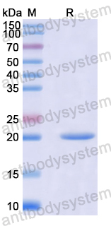 Recombinant Human KMT2D Protein, N-His