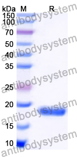Recombinant Human ITGB1BP1 Protein, N-His