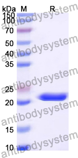 Recombinant Human TRDMT1 Protein, N-His